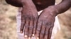 Abahinga Basaba ko Ibihara vy'Inkende Vyoreka Kwitirirwa Afurika 