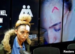 Gabriella Engels, qui accuse Grace Mugabe de l'avoir agressé.