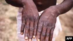 Uwanduye ibihara vy'inkende