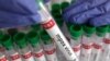 La RDC lance la vaccination contre le mpox