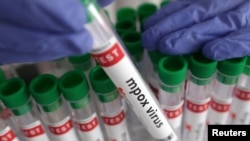 Un tube à essai étiqueté « virus mpox positif » est présenté dans cette illustration prise le 20 août 2024. (Reuters/Dado Ruvic/Illustration/Archives)