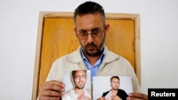 Mohammed Ghannam shows photographs depicting what he says are injuries sustained when he was detained by Palestinian security forces, at his home in the West Bank village of Dura, near Hebron, May 12, 2013. 