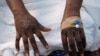Les mains d'un patient souffrant d'éruptions cutanées causées par le virus mpox. Kinshasa, 30 août 2024. Reuters / Justin Makangara